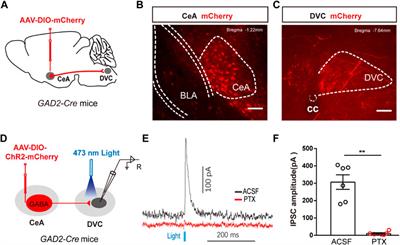 A central amygdala input to the dorsal vagal complex controls gastric motility in mice under restraint stress